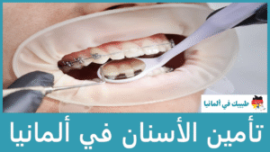 تأمين الأسنان في ألمانيا
