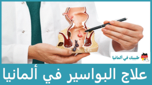 علاج البواسير في ألمانيا