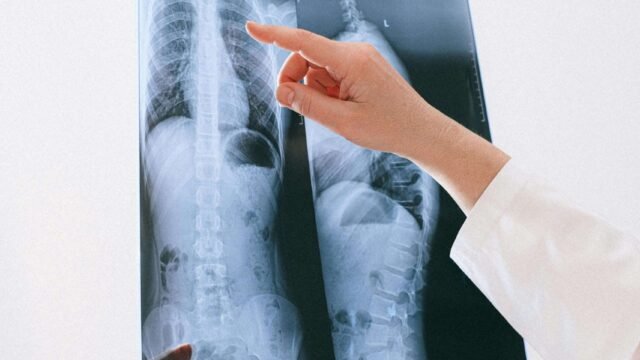 الدكتور أوزجان أصلان – خبير الأعصاب وجراحة العمود الفقري في إيسن Bredeney