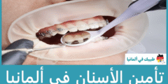 تأمين الاسنان في ألمانيا